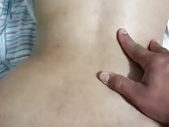 E prolapse anal debbo, puccu debbo.