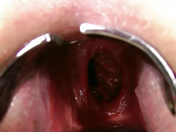 Fisting anal ɗiɗo, ɓuuɓri, gaping daarorgal galle alɗungal.